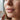 Model with glossy lips holding Skin Monarch Pigment Booster Formula 30ml balm jar